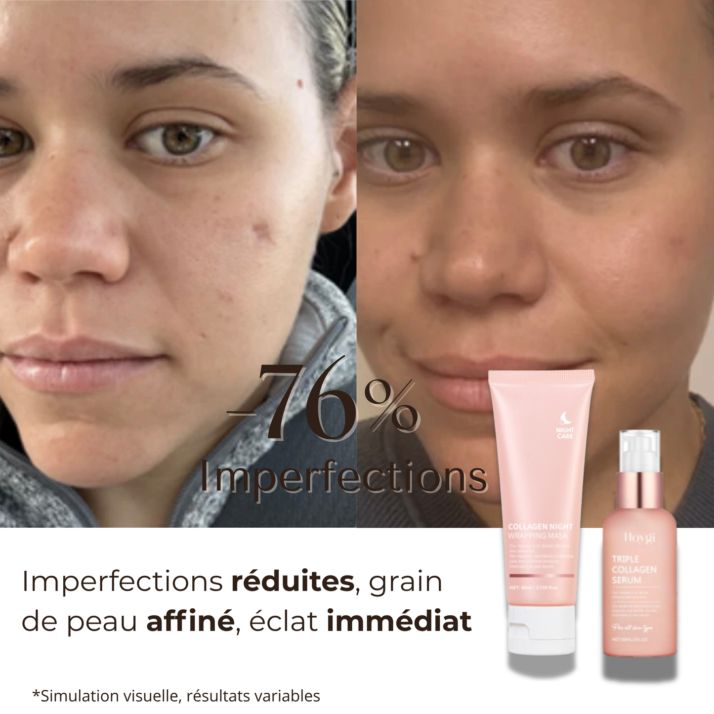 Masque de Nuit Triple Collagène™